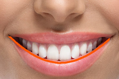 طرح خدمات سلامت دهان و دندان چه افراد و بخش هايي را پوشش مي دهد