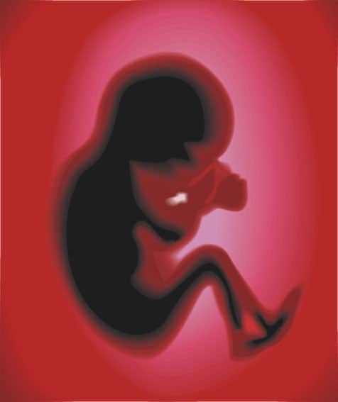 ۵ سقط جنین در طرح پیشگیری از معلولیت در سال گذشته